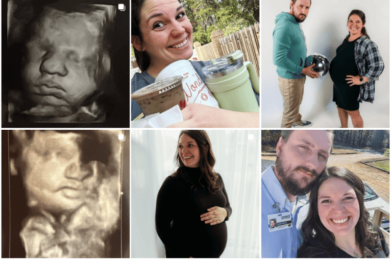 Dos úteros y en ambos embarazada