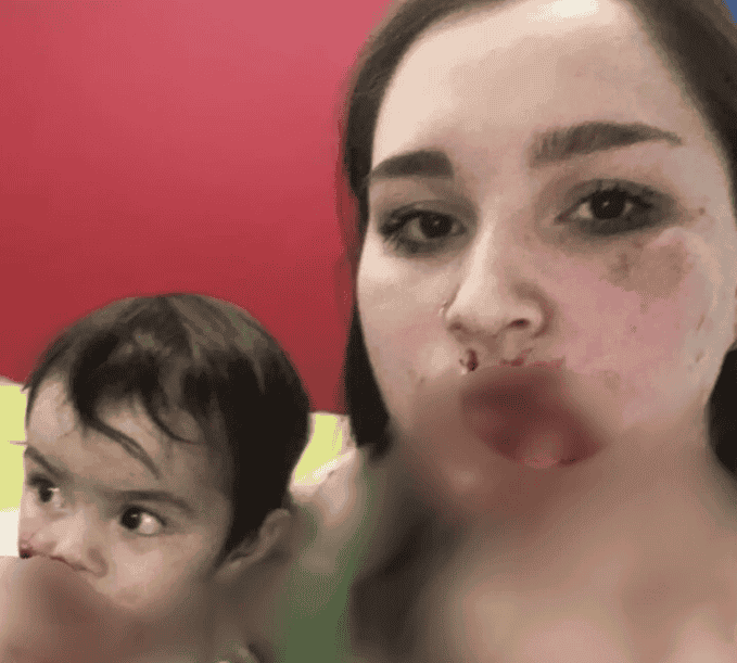 La imagen que subió la víctima a sus redes. 