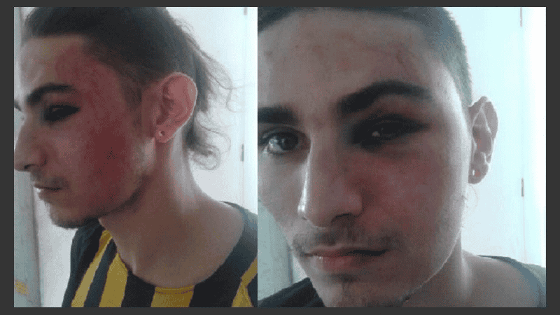 Sasha, una de las víctimas, sufrió una golpiza y también le cortaron una rasta.&nbsp;