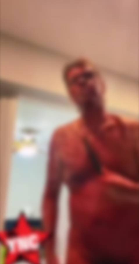 Perez Hilton terminó hospitalizado por las laceraciones que se autoinfligió.