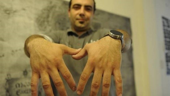 Batsios se implantó los chips en ambas manos, entre el pulgar y el índice. (Foto: Alfredo Martínez / Clarín)